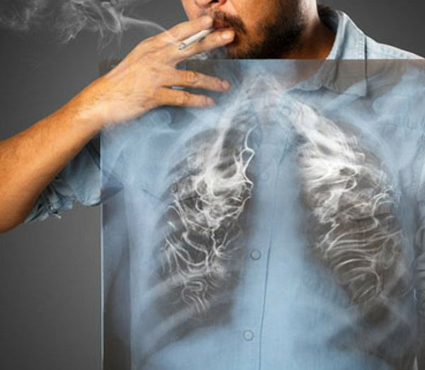 ترک سیگار برای درمان حساسیت ریه