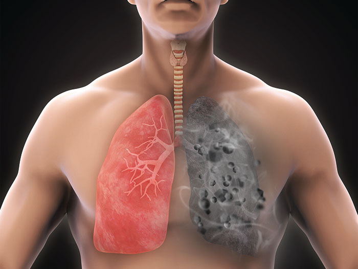 تاثیر گرد و غبار و ذرات معلق بر ریه ها تصفیه هوای هانیول